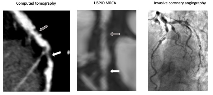 Image of the Month - April 2019. Magnetic resonance angiography using ferahaem. Figure 1