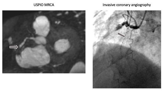Image of the Month - April 2019. Magnetic resonance angiography using ferahaem.. Figure 2