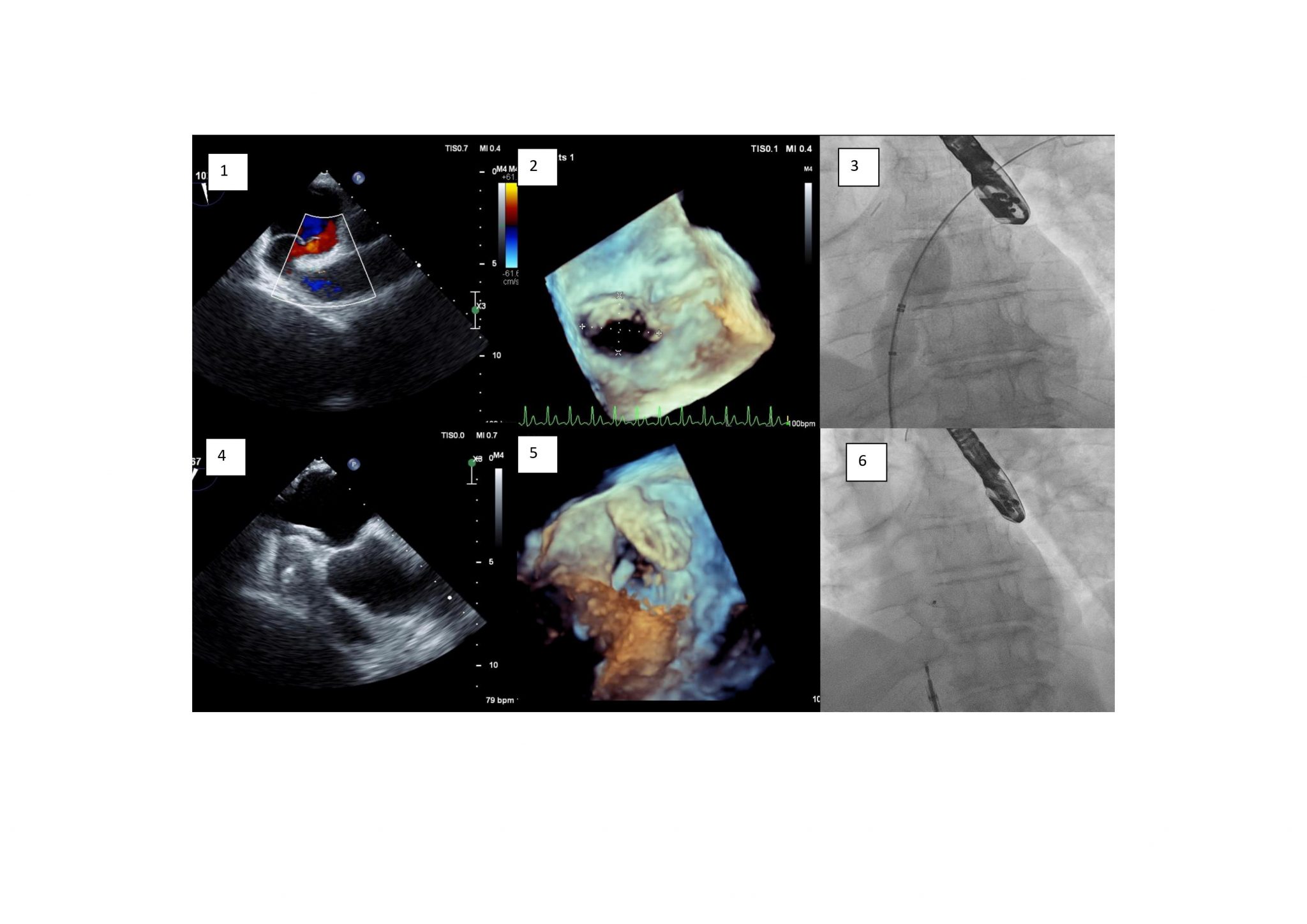 Image of the Month December 2021 Closing Holes in Hearts British